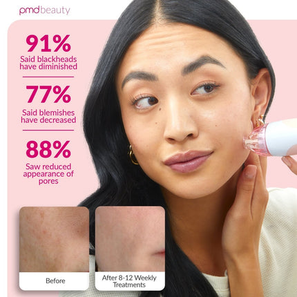 PMD Personal Microderm Clasico