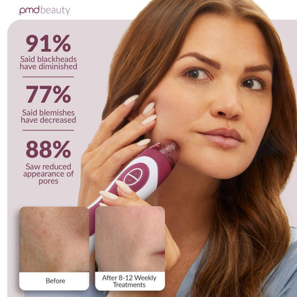 PMD Personal Microderm Elite Pro