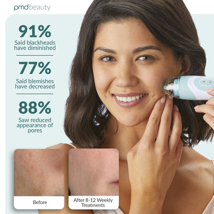 PMD Personal Microderm Elite Pro